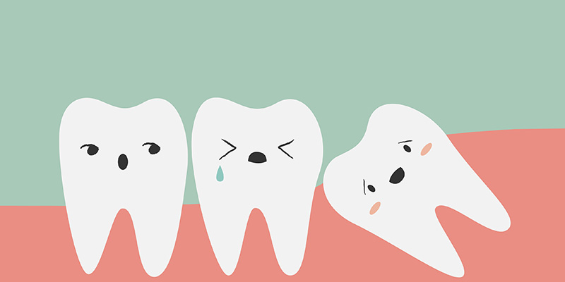 Wisdom Tooth Extraction